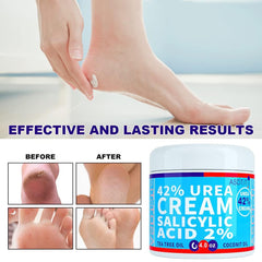 Foot care cream with salicylic acid tea tree oil and shea butter