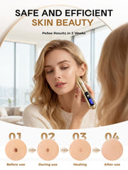 Fine tips disposable for hygiene on Skin Tag Remover Pen