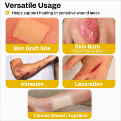 Petrolatum gauze dressing 4x4 inch AWD Medical Xeroform image 4