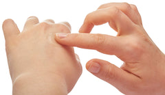 portable 0.7 ounce bite relief gel