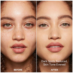 Dark Spot Corrector for Face and Body packaging