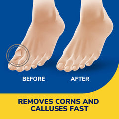 Maximum strength medicated liquid with salicylic acid for feet