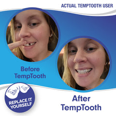 FDA approved material used in Temptooth kit