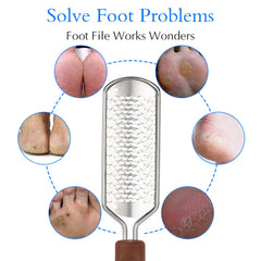 Hard skin remover pedicure rasp for calloused feet
