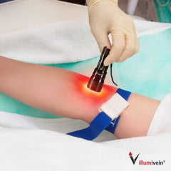 Shadow-assisted vein finding demonstrated in clinical setting