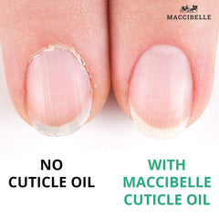 4 Ounce bottle of Maccibelle Cuticle Oil For Nails Pineapple