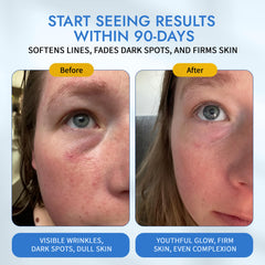 Hyaluronic acid and ceramides hydrate the serum