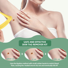 36 skin repair patches and 10 cleansing wipes included in kit