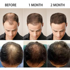 minoxidil hair growth scalp cream for men product shot