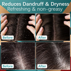 minoxidil hair growth scalp cream for women product shot