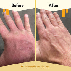 Colloidal oatmeal helps soothe irritation in a gentle hand soap