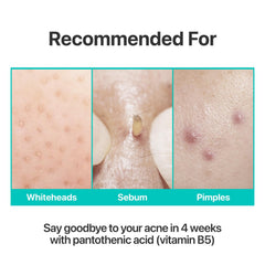 numbuzin No1 Pantothenic B5 Active Soothing Cream aczero sophora ingredients