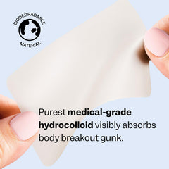 Oversized hydrocolloid patch targets larger breakout clusters