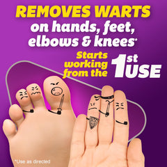 Silka Pointts Wart Remover Freeze Off for hands and feet