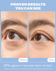 Snail mucin eye cream under eyes product image