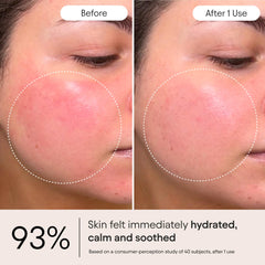 Snap 8 peptide feature in ALPYN cream