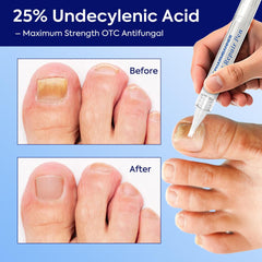 Professional nail file included for nail prep