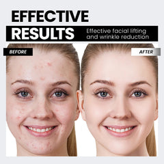 V-shaped face device for contouring and lift