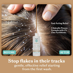 Panthenol formulation in DHS Shampoo