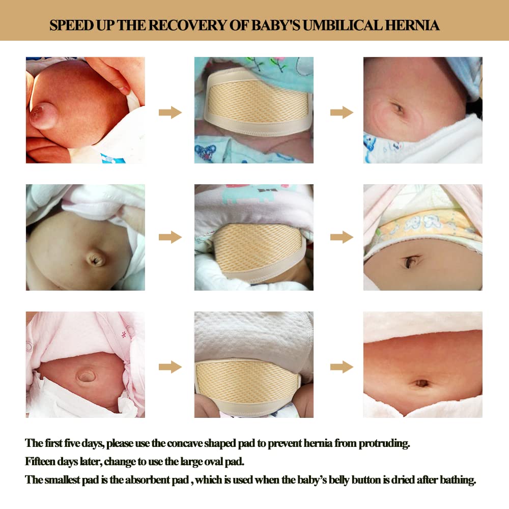 size reference 15-20 inch umbilical belt