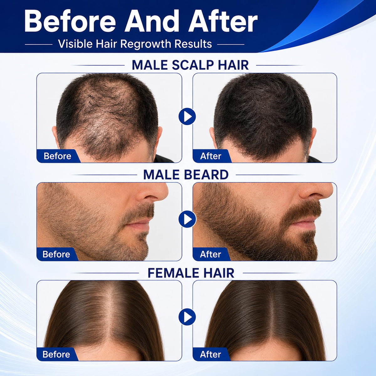 5% Minoxidil for Stronger Thicker Fuller Hair& Beard product image with Biotin and Batana Oil
