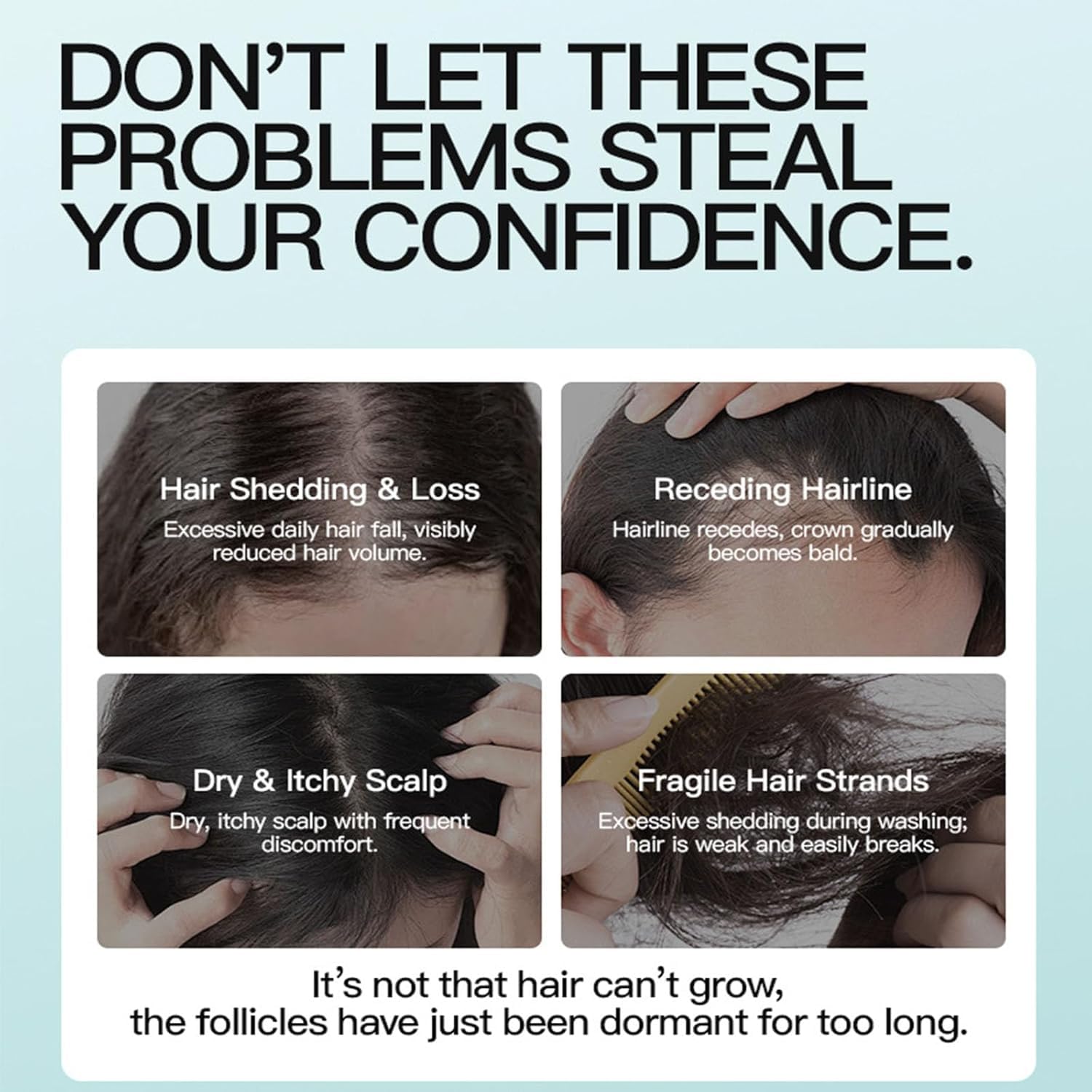 5 percent minoxidil scalp massage cream product box