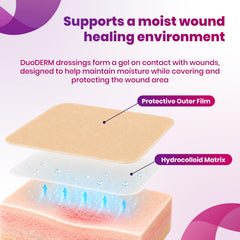 5 count box of DuoDERM CGF 4x4 dressings