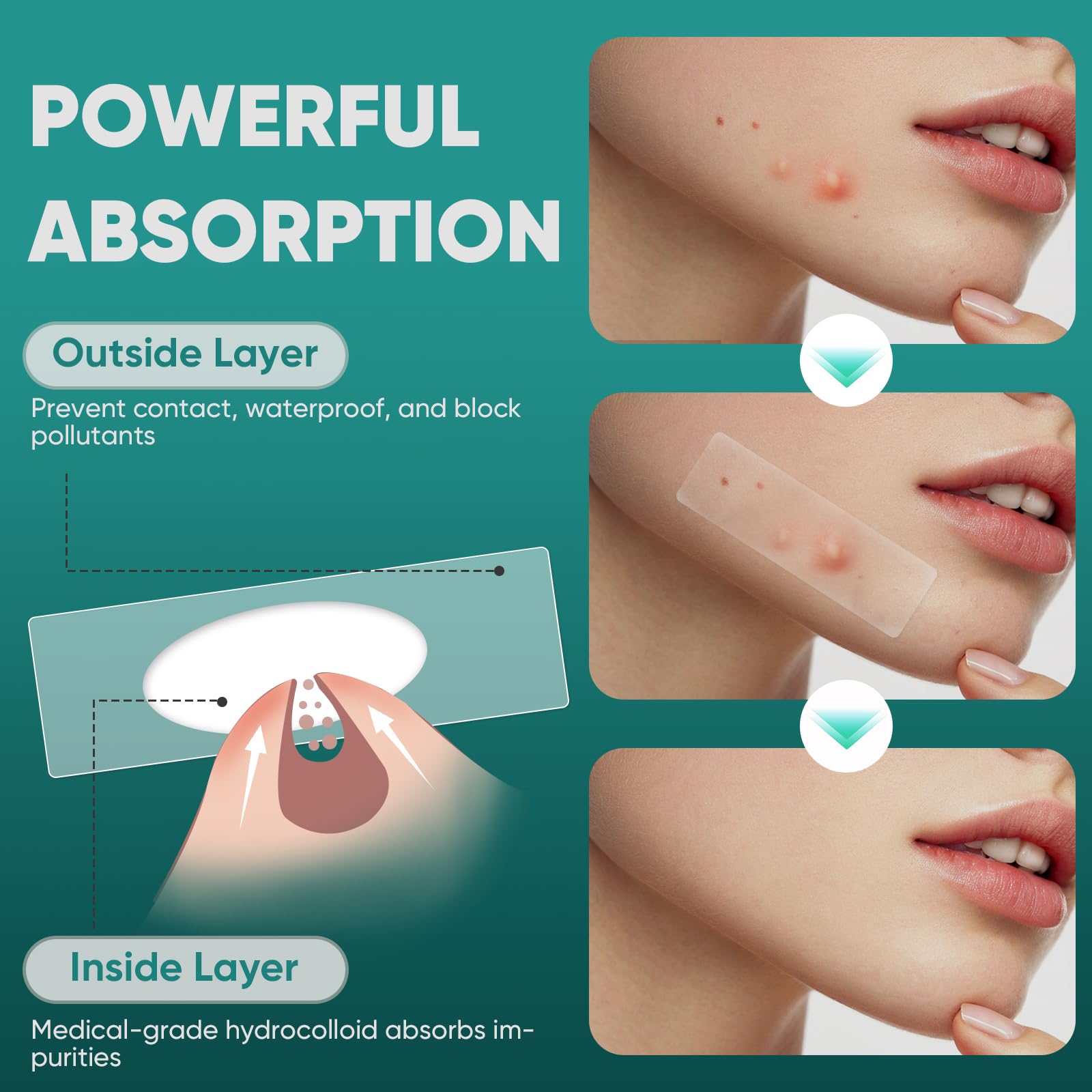 vegan cruelty-free hydrocolloid acne patches by kindshine
