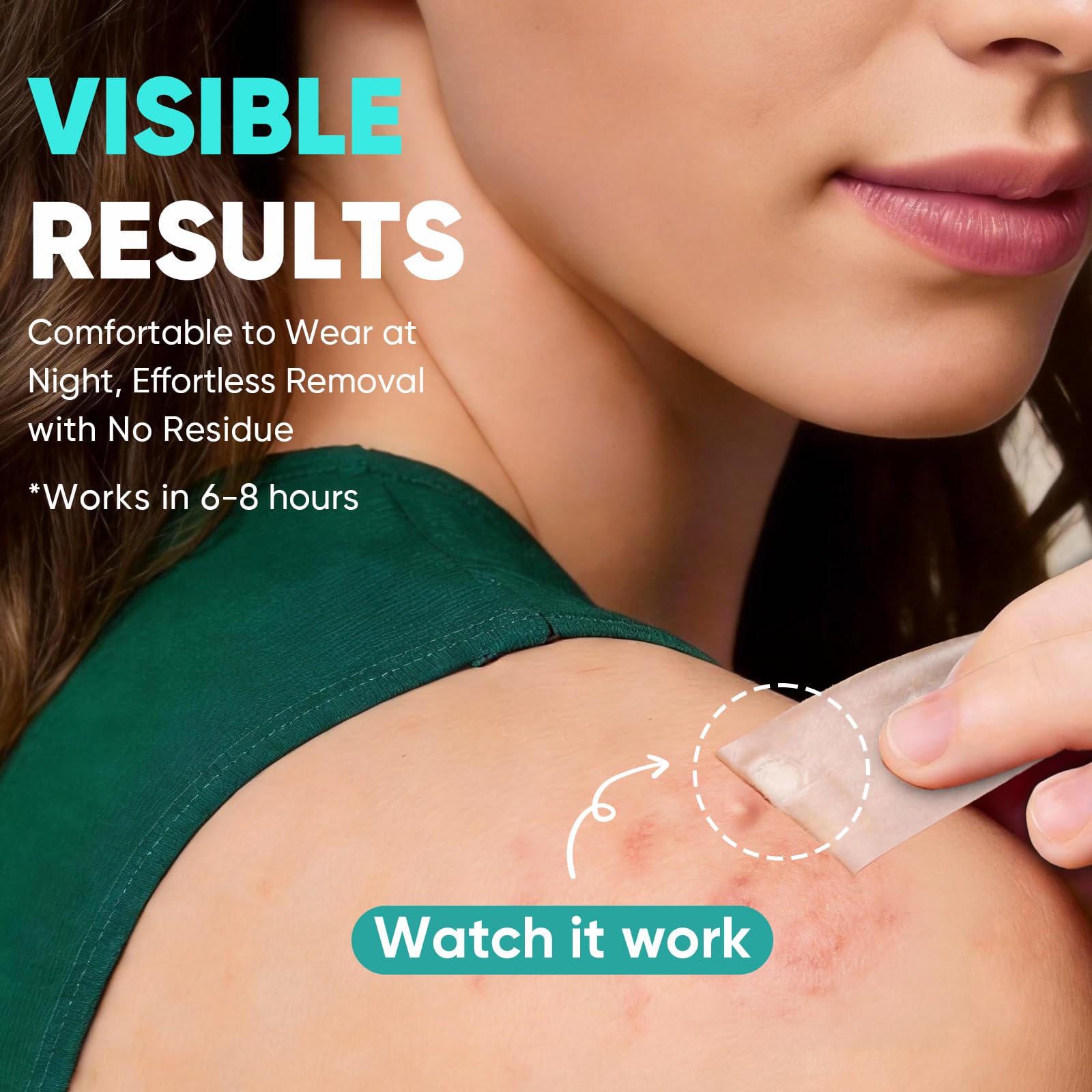96-count pimple patches for facial back and body use