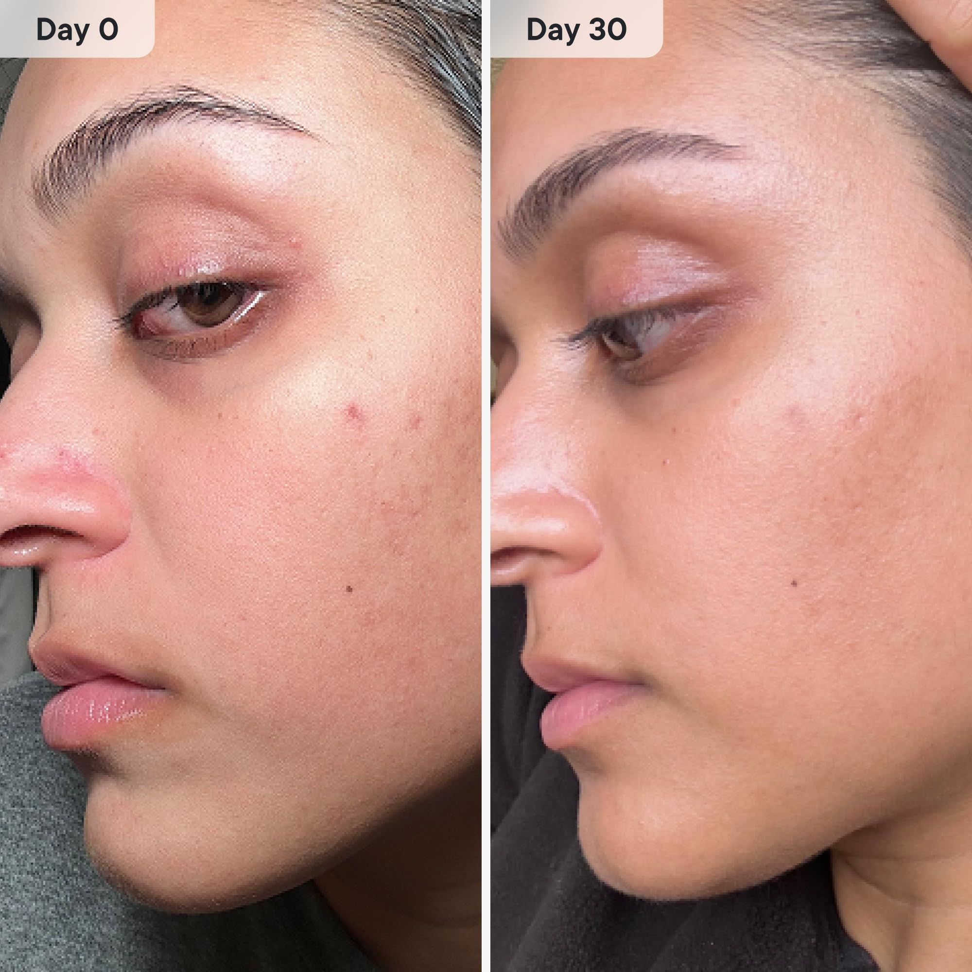 All skin types suitability mentioned on packaging