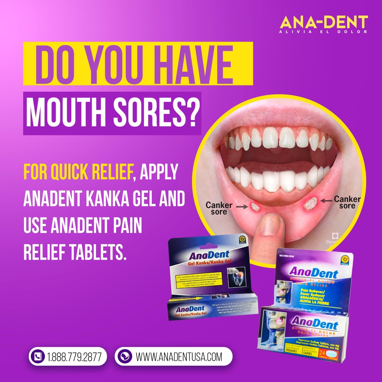 Anadent Toothache Gel packaging for oral pain relief