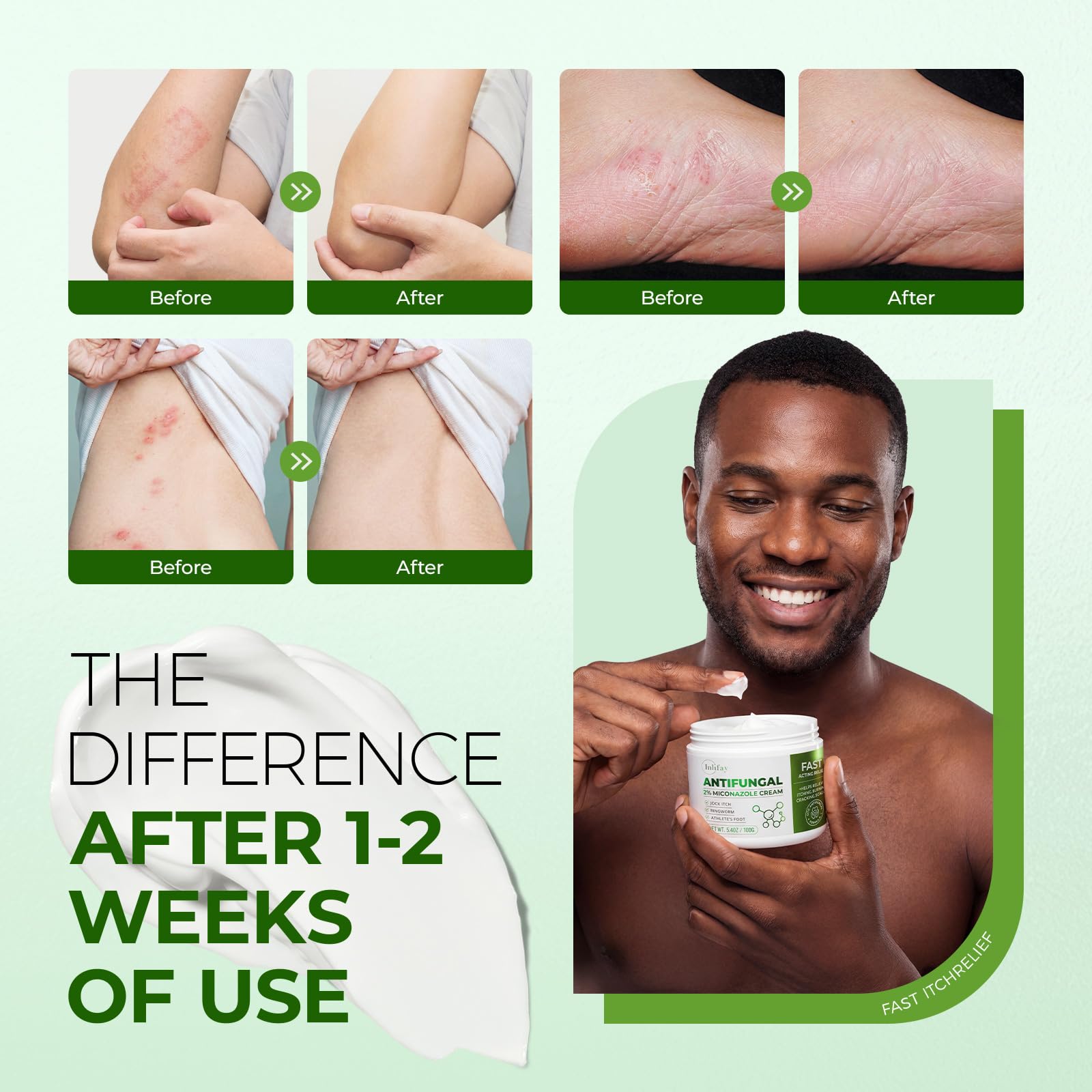 Inlifay gym protection antifungal cream tube