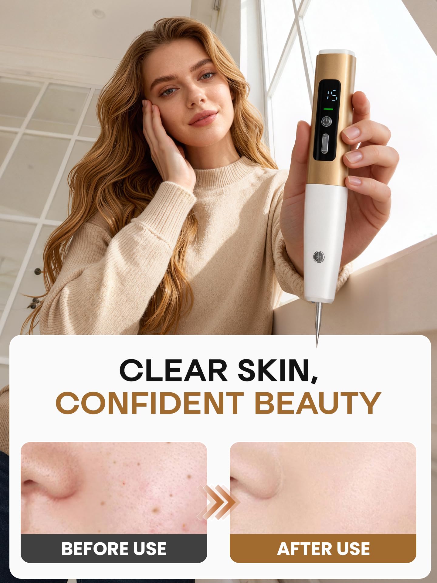 At home use device for removing skin tags and small moles