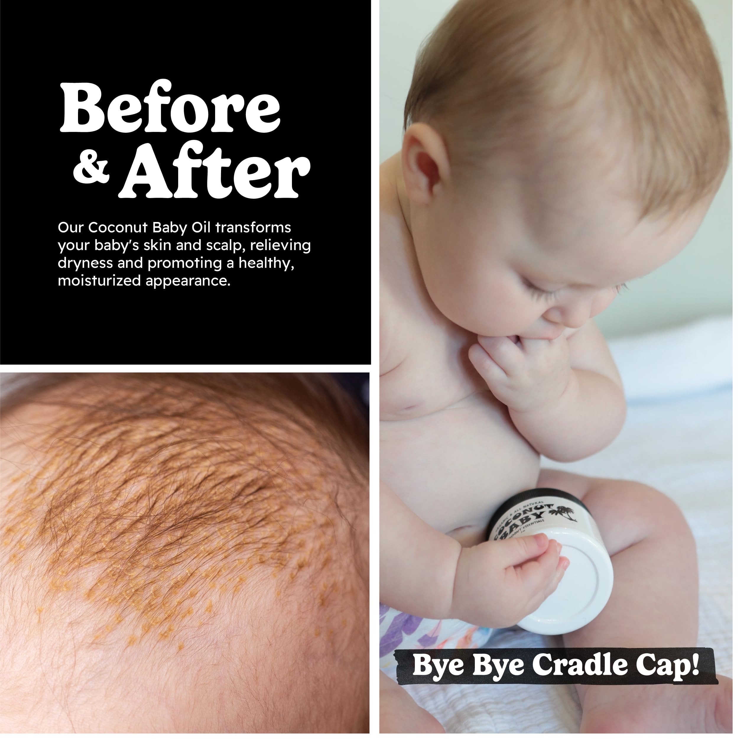 Chemical-free formula for extra-sensitive skin