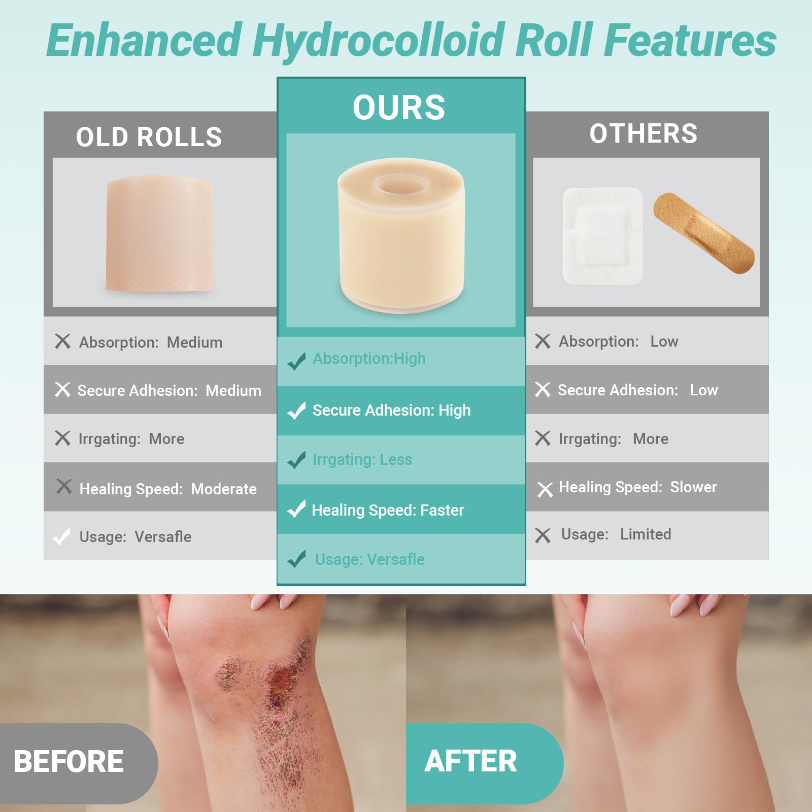 DIY size hydrocolloid dressings for wounds burns and acne