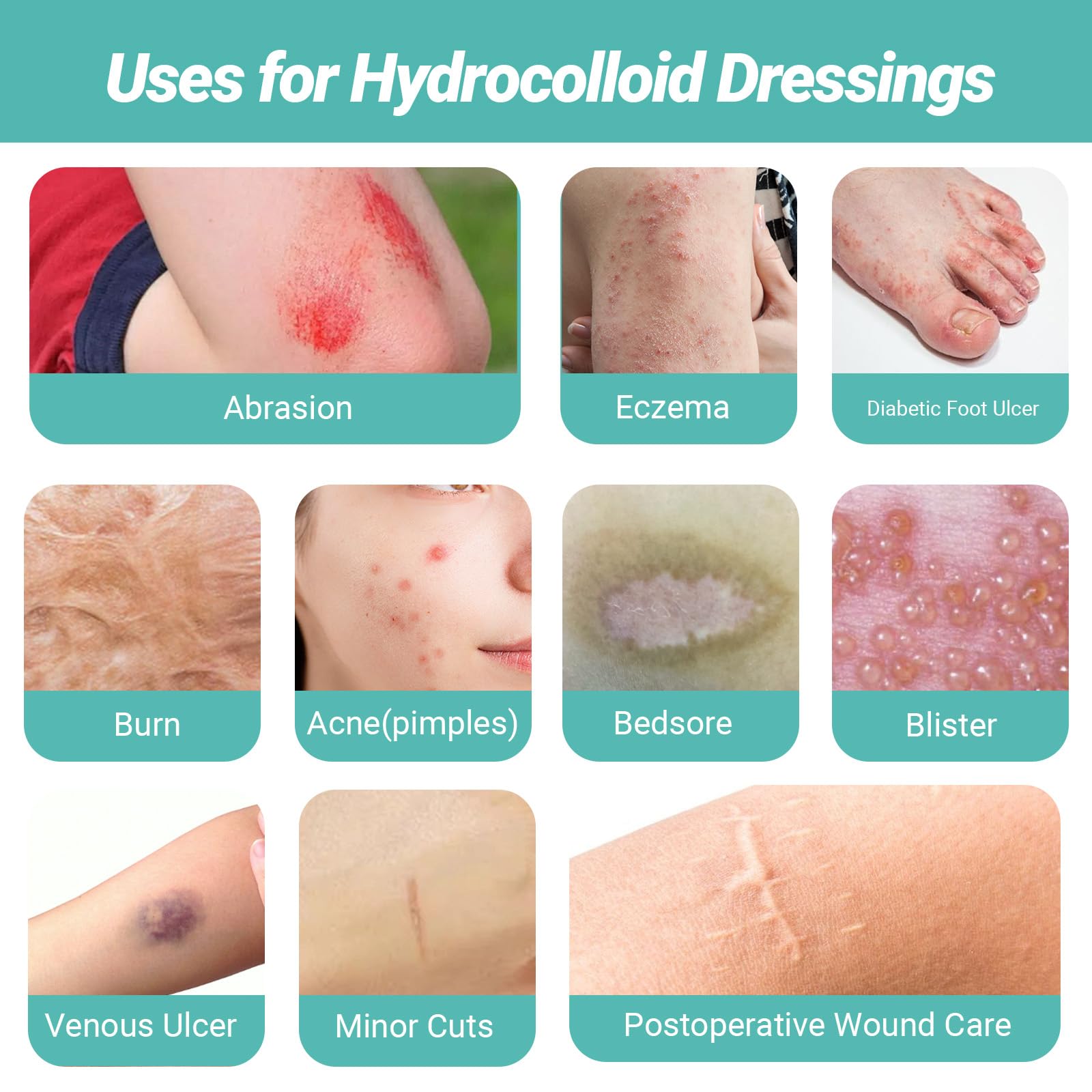 Ultra-thin breathable waterproof hydrocolloid dressing on skin