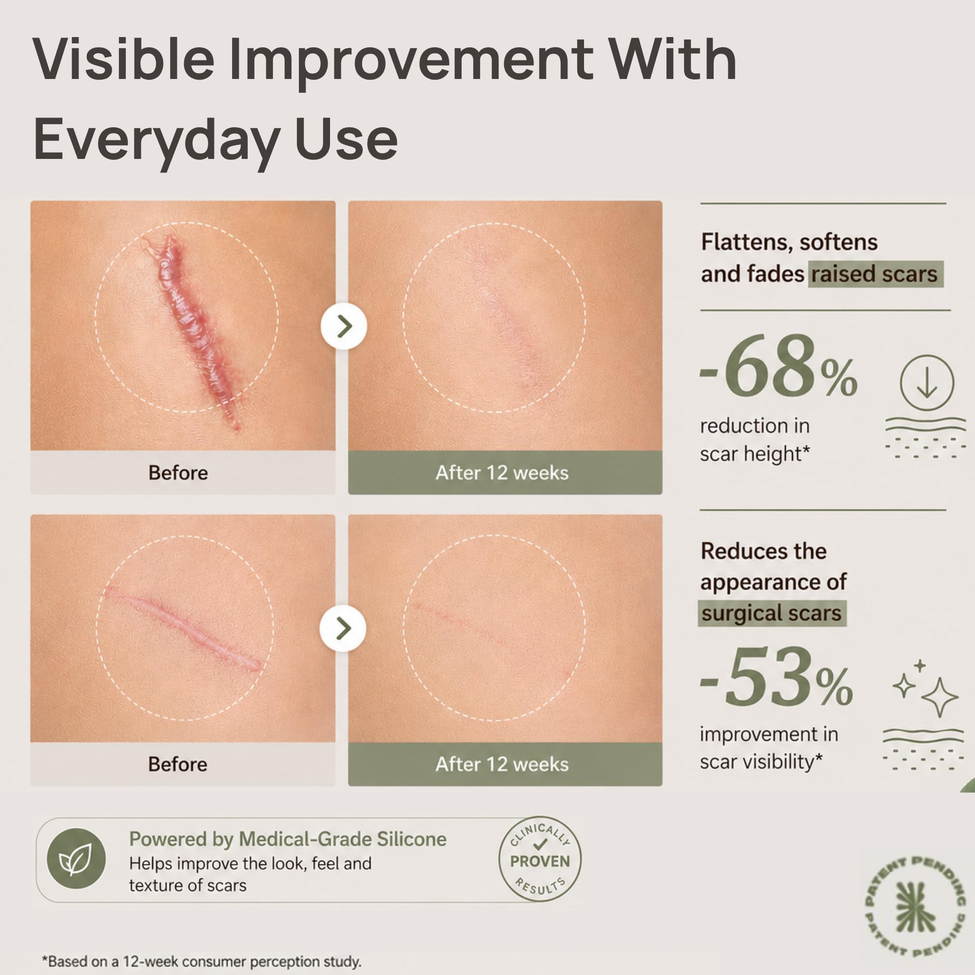 Base18 HydroSil Scar Gel 30ml applied to acne scar