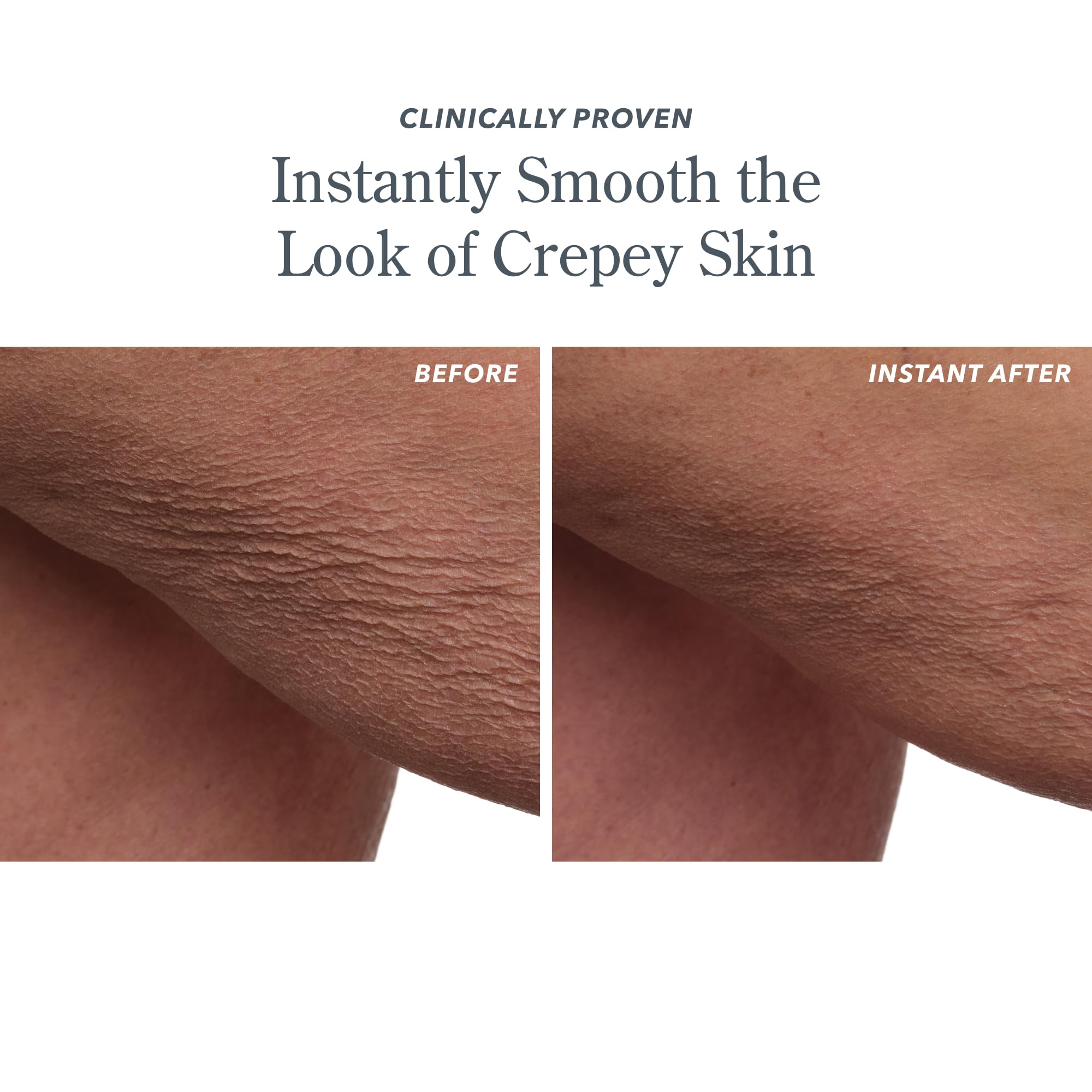 Reneseed peptides improve elasticity and texture