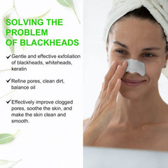 Blackheads removal nose strips close up