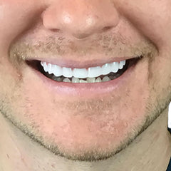Sizing reference front four teeth approximately 1 1/8 inch across
