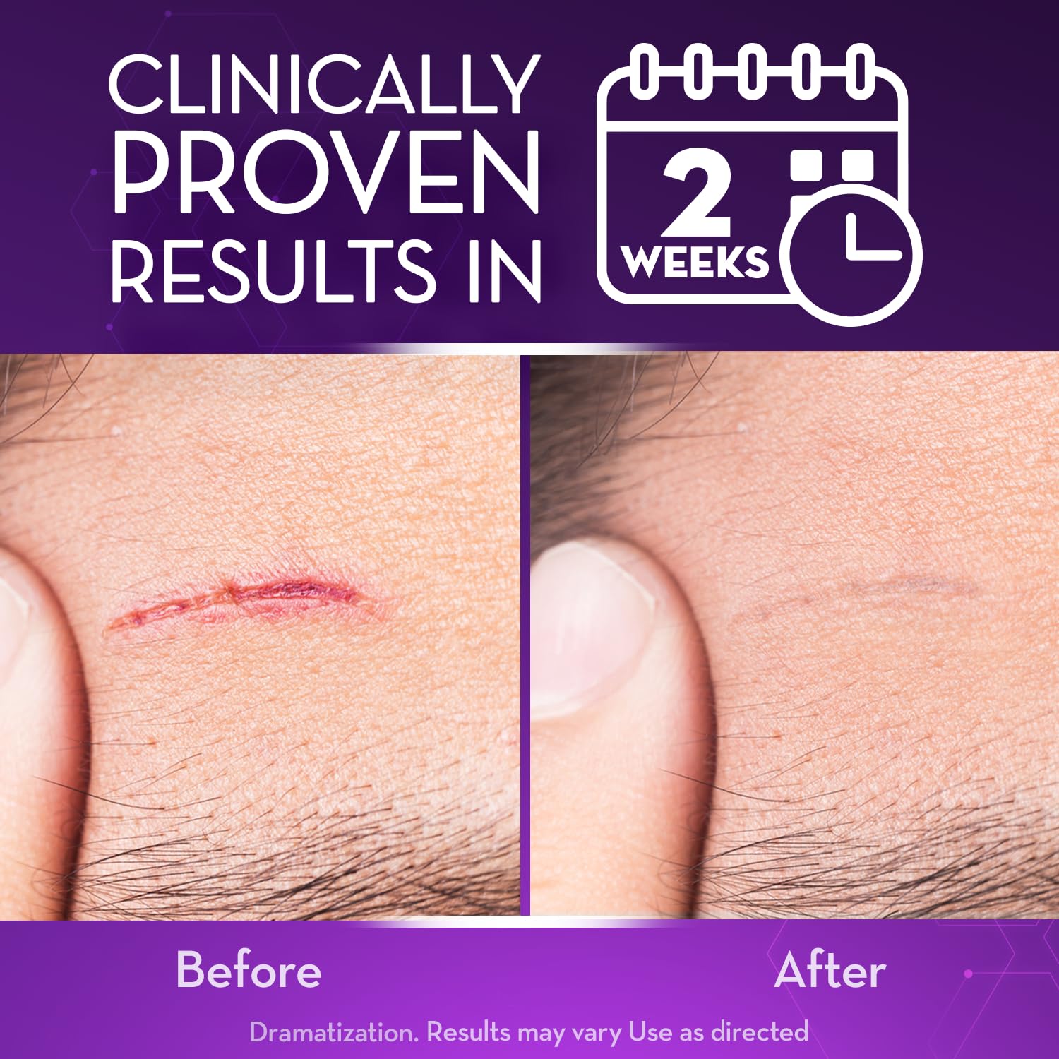 Close up of Cicatricure Advanced Scar Gel tube