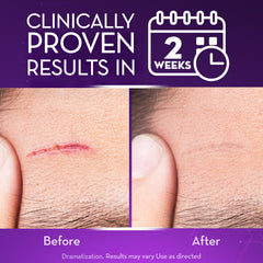Close up of Cicatricure Advanced Scar Gel tube