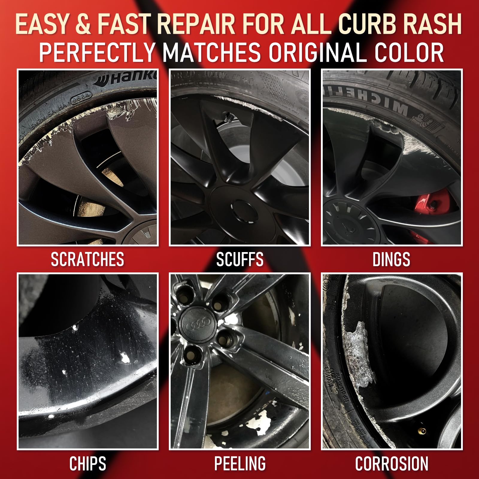Cleaning wipes and disposable gloves in SMAPHY curb rash kit
