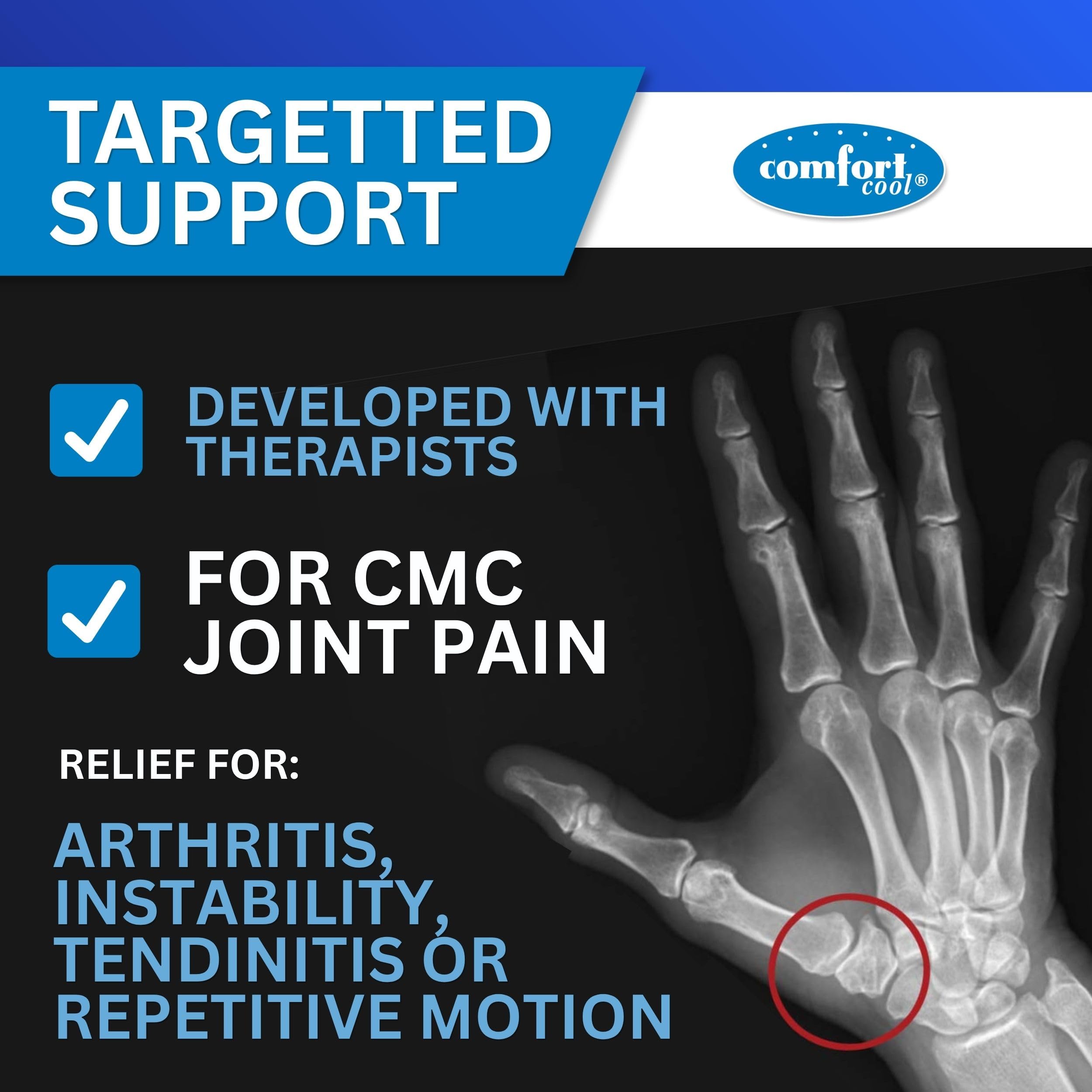 Trim option below MP Joint on Comfort Cool Thumb CMC Restriction Splint
