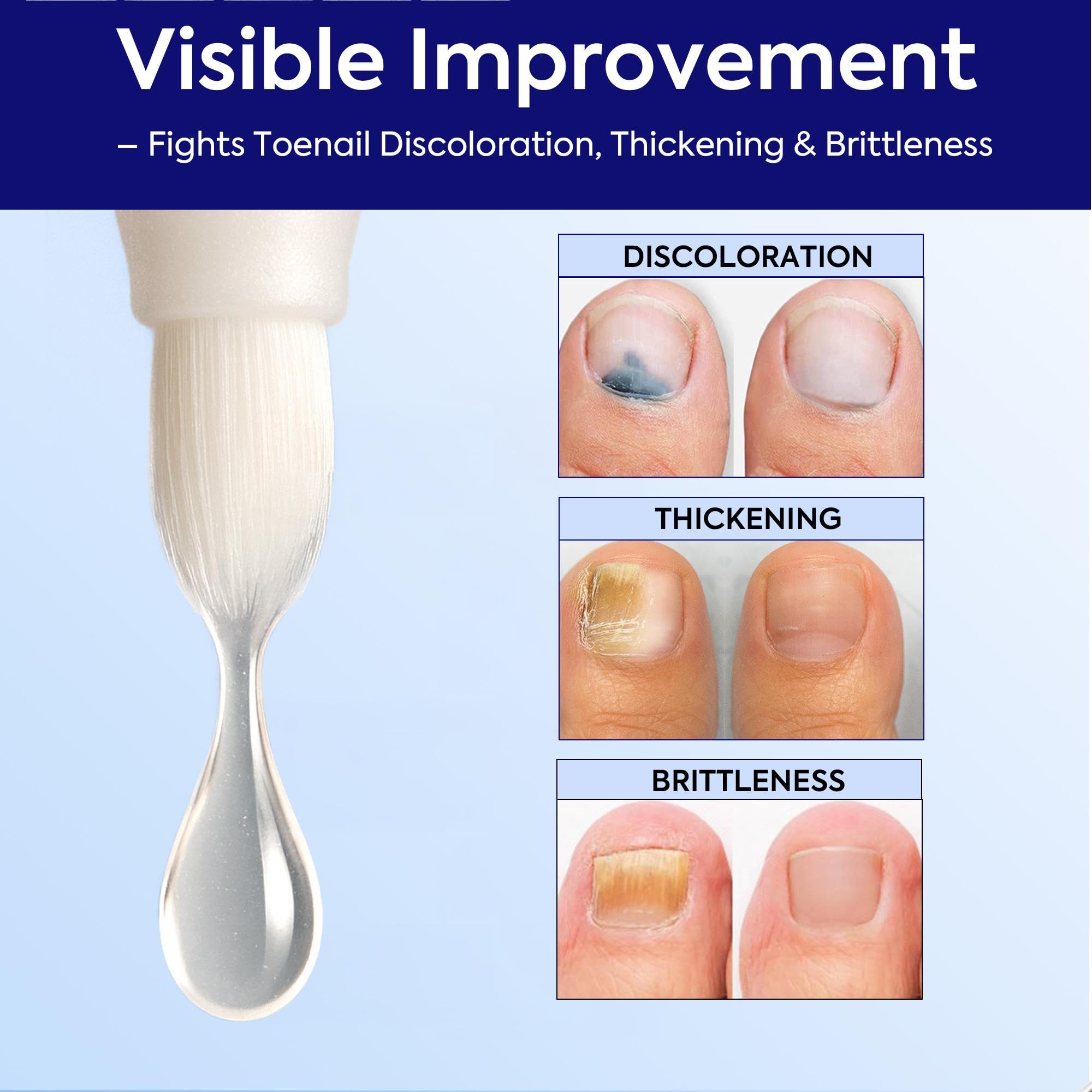 Close up of precision application brush included in kit