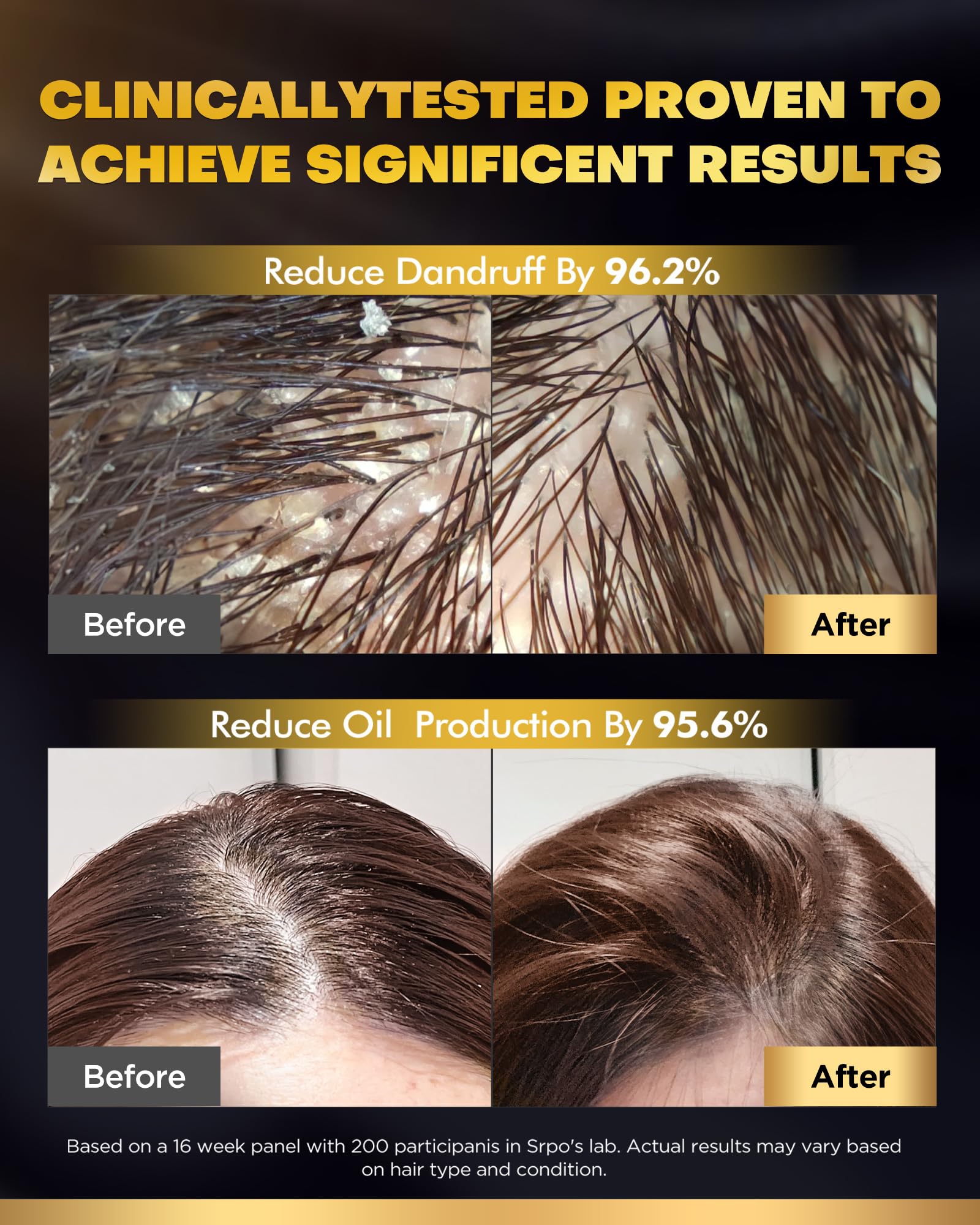 Two-in-one COOLKESI hair growth set for men and women
