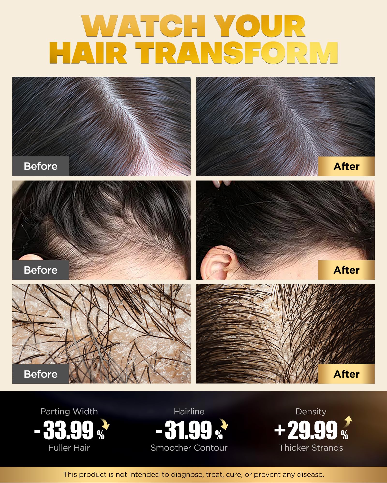 Onion extract anti-loss hair care by COOLKESI