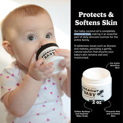 Cradle cap relief for newborns with coconut oil