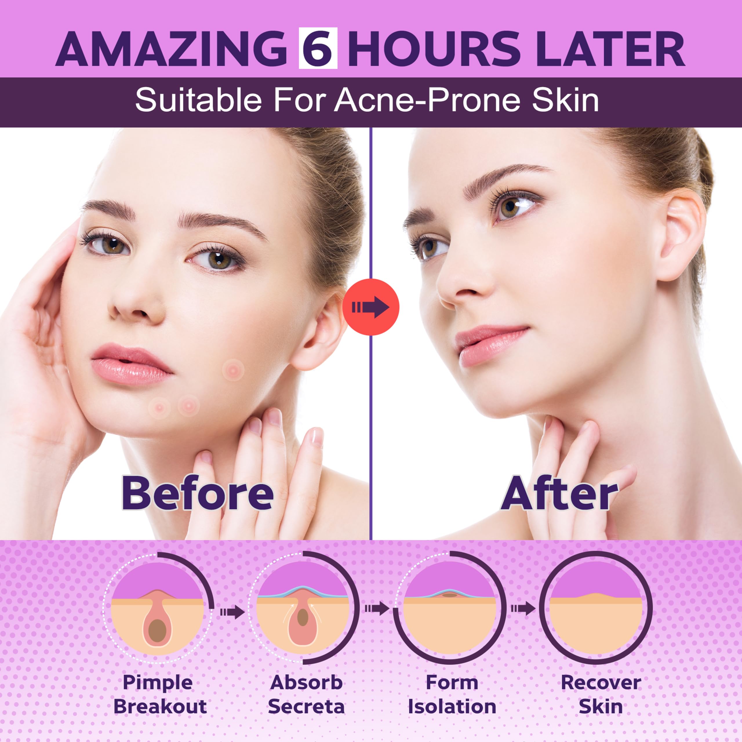 Daily blemish care patches showcased for face
