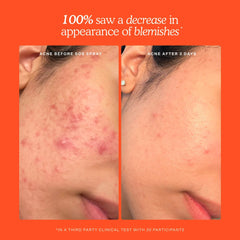 Daily Balancing Gel Cleanser product image
